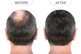 Rosemary Hair Growth Oil