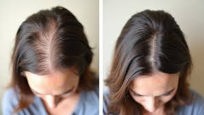 Rosemary Hair Growth Oil
